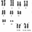 Intraspecies multiple chromosomal variations ...