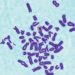 ﻿A rare chromosomal polymorphism in a ...